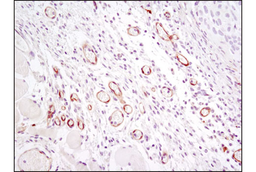 Immunohistochemistry Image 3: VEGF Receptor 2 (D5B1) Rabbit Monoclonal Antibody (BSA and Azide Free)