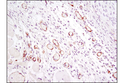 Immunohistochemistry Image 3: VEGF Receptor 2 (D5B1) Rabbit mAb (BSA and Azide Free)