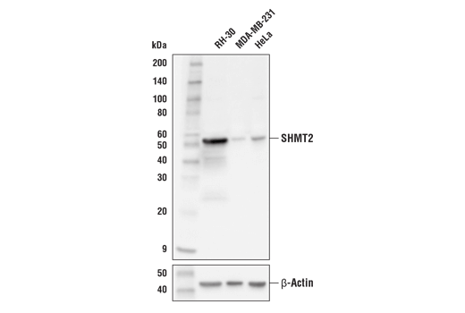 Western Blotting Image 1: SHMT2 (E7F4Q) Rabbit mAb