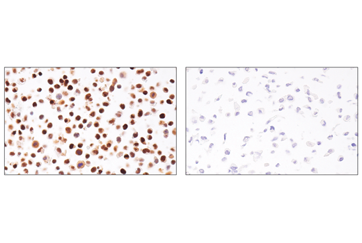 Immunohistochemistry Image 3: p14 ARF (E3X6D) Rabbit mAb (BSA and Azide Free)