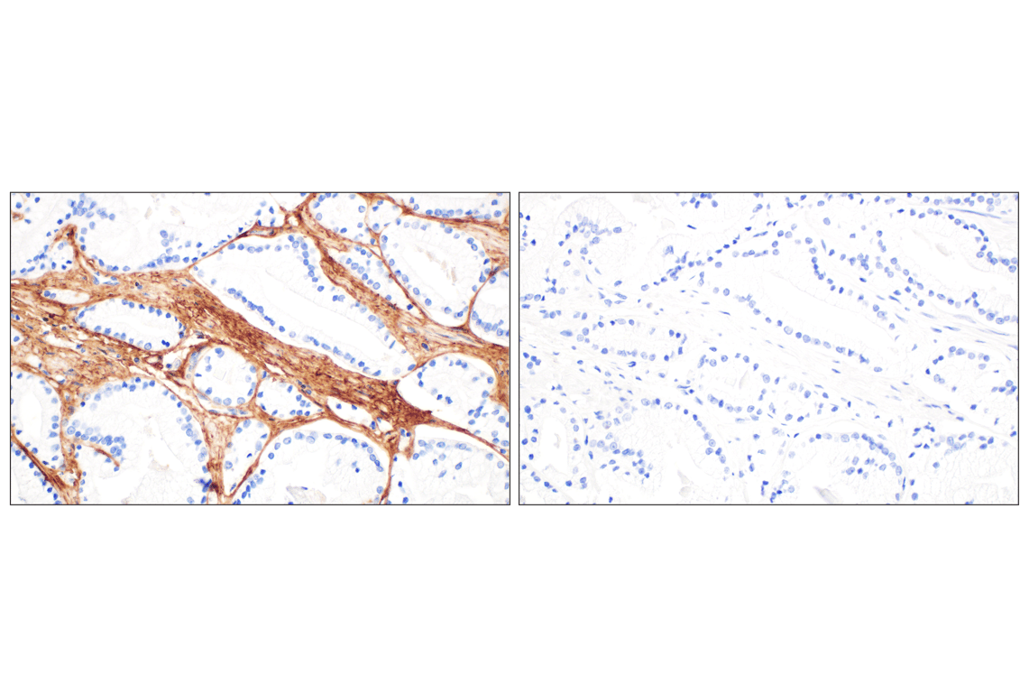 Immunohistochemistry Image 5: COL6A1 (E9U3B) Rabbit Monoclonal Antibody (BSA and Azide Free)