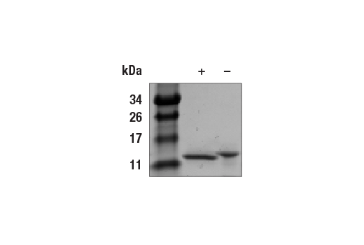 undefined Image 2: Human beta-NGF Recombinant Protein