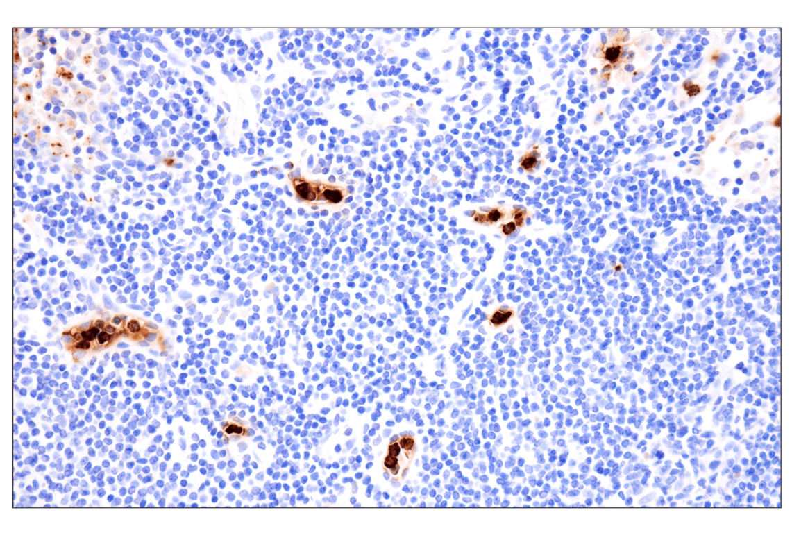 Immunohistochemistry Image 8: Neutrophil Elastase (F4H3X) Rabbit Monoclonal Antibody