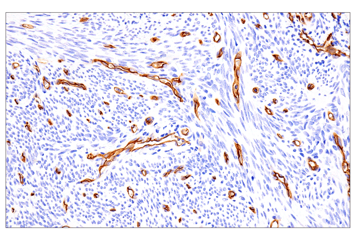 Immunohistochemistry Image 9: EMCN (E3Z4D) Rabbit Monoclonal Antibody (BSA and Azide Free)
