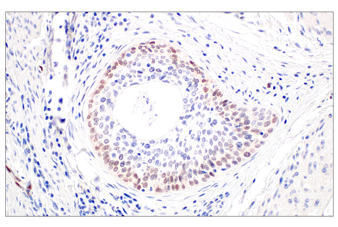 Immunohistochemistry Image 2: ARK5 (E4T2A) Rabbit Monoclonal Antibody