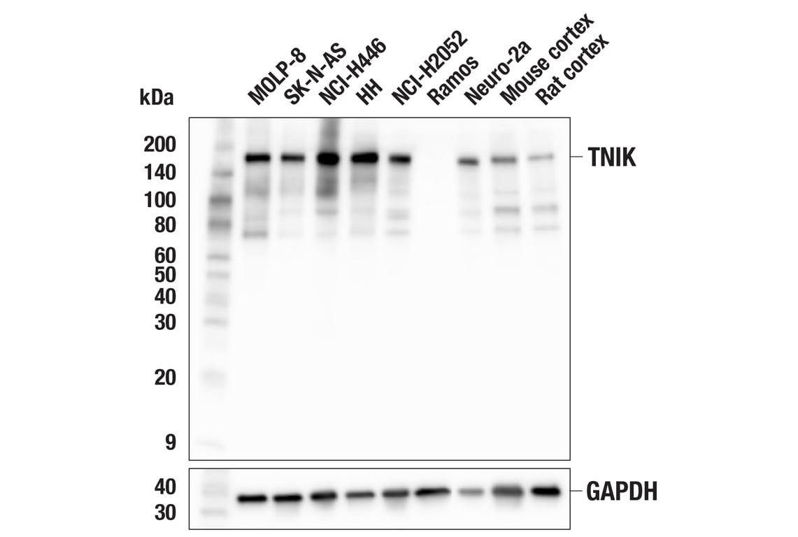 Western Blotting Image 2: TNIK (F7V3J) Rabbit Monoclonal Antibody