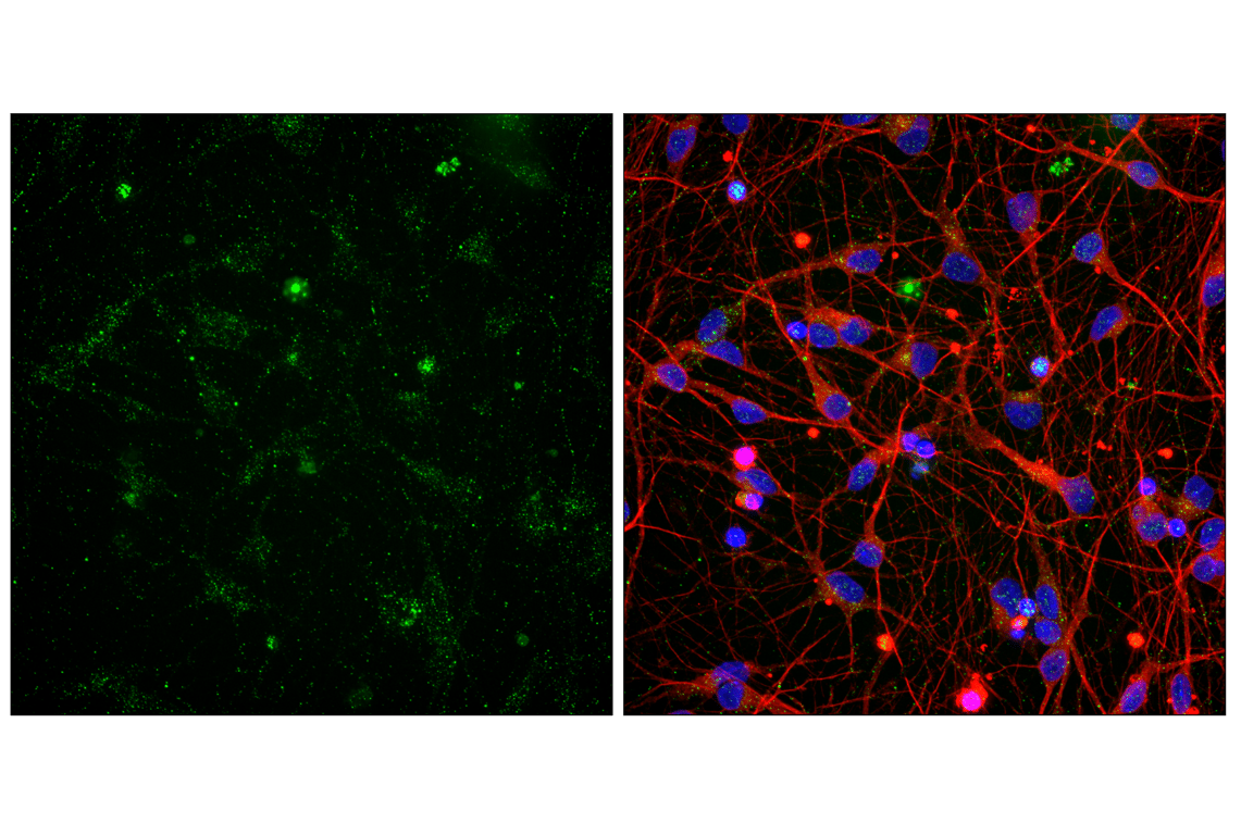 Immunofluorescence Image 1: AMPA Receptor 4 (GluA 4) (D41A11) Rabbit Monoclonal Antibody