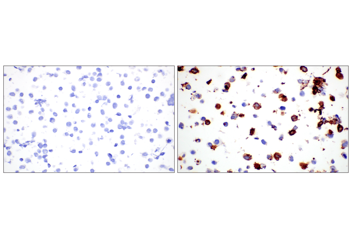 Immunohistochemistry Image 11: CD44 v5 (C44Mab-3) Mouse Monoclonal Antibody