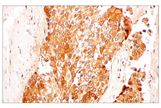 Immunohistochemistry Image 3: c-Rel (E8Z5Y) Rabbit Monoclonal Antibody