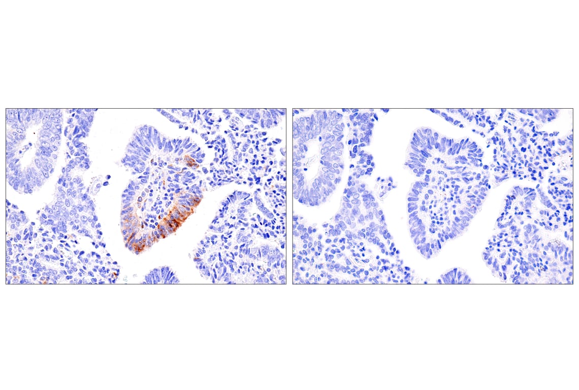 Immunohistochemistry Image 5: CXCL9/MIG (E6Z5W) Rabbit Monoclonal Antibody