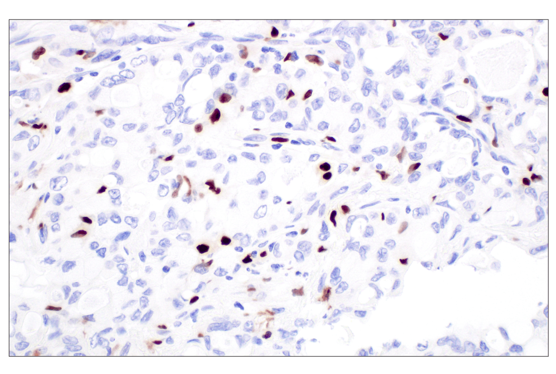 Immunohistochemistry Image 2: MNDA (3C1) Rat Monoclonal Antibody