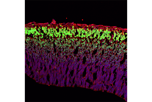 Immunofluorescence Image 1: TBR1 (D6C6X) Rabbit Monoclonal Antibody