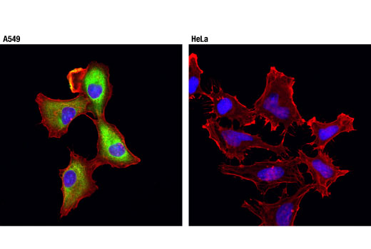 Immunofluorescence Image 1: ALDH1A1 (D9J7R) Rabbit Monoclonal Antibody