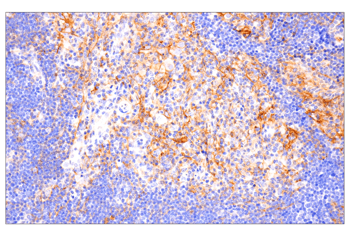 Immunohistochemistry Image 2: PD-L1 (F3Z1T) Rabbit Monoclonal Antibody (BSA and Azide Free)
