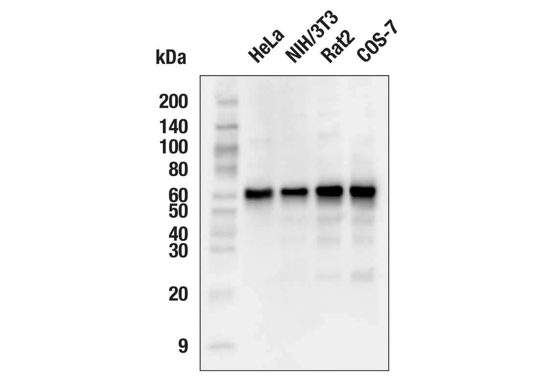 Western Blotting Image 1: Akt (pan) (40D4) Mouse mAb