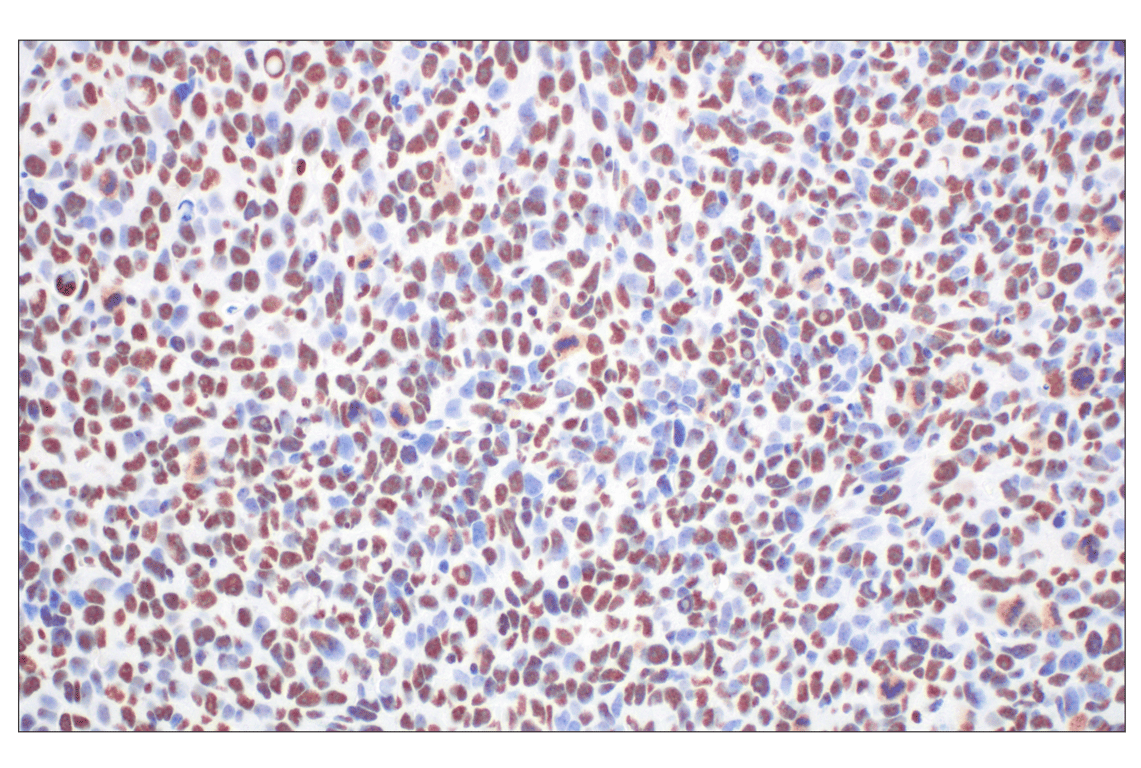 Immunohistochemistry Image 9: CBX7 (E7N1W) Rabbit Monoclonal Antibody
