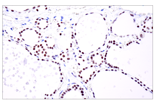 Immunohistochemistry Image 9: PBRM1/BAF180 (D4L9X) Rabbit Monoclonal Antibody (BSA and Azide Free)