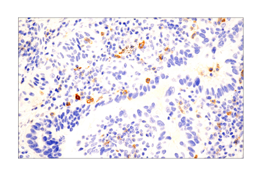 Immunohistochemistry Image 5: TNFRSF8/CD30 (E7E4D) Rabbit Monoclonal Antibody