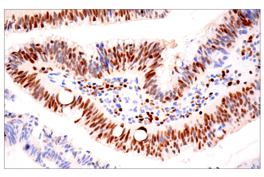 Immunohistochemistry Image 2: Tox/Tox2 (E6I3Q) Rabbit Monoclonal Antibody