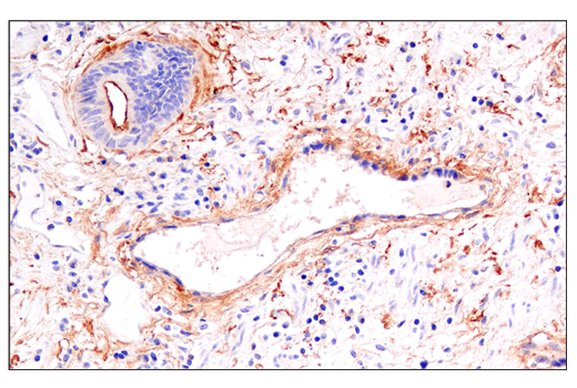 Immunohistochemistry Image 2: DAF/CD55 (E7G2U) Rabbit Monoclonal Antibody