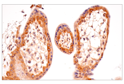 Immunohistochemistry Image 8: B-Raf (E3T5C) Mouse Monoclonal Antibody