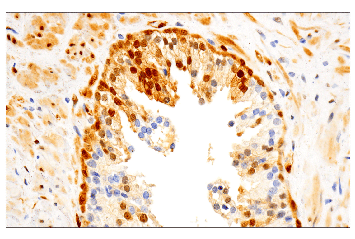 Phospho-Erk1/2 Pathway Antibody Sampler Kit | Cell Signaling