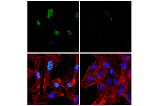 Immunofluorescence Image 1: CASC5 (E4A5L) Rabbit Monoclonal Antibody