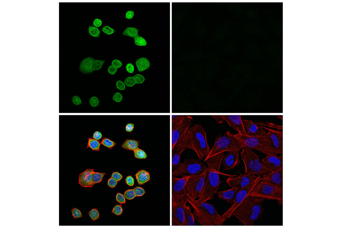Immunofluorescence Image 1: UNC93B1 (E4W2T) Rabbit Monoclonal Antibody
