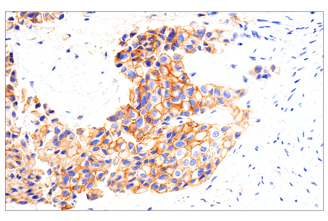 Immunohistochemistry Image 1: EphA2 (D4A2) XP<sup>®</sup> Rabbit mAb (BSA and Azide Free)