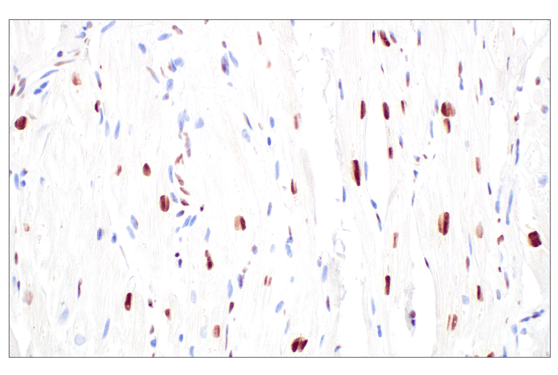 Immunohistochemistry Image 4: CBX7 (E7N1W) Rabbit Monoclonal Antibody