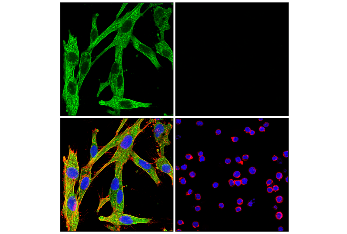 Immunofluorescence Image 1: Annexin V (E3W8V) Rabbit Monoclonal Antibody