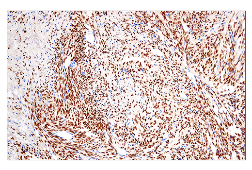 Immunohistochemistry Image 1: SSX (E5A2C) Rabbit Monoclonal Antibody (Carboxy-terminal Antigen)