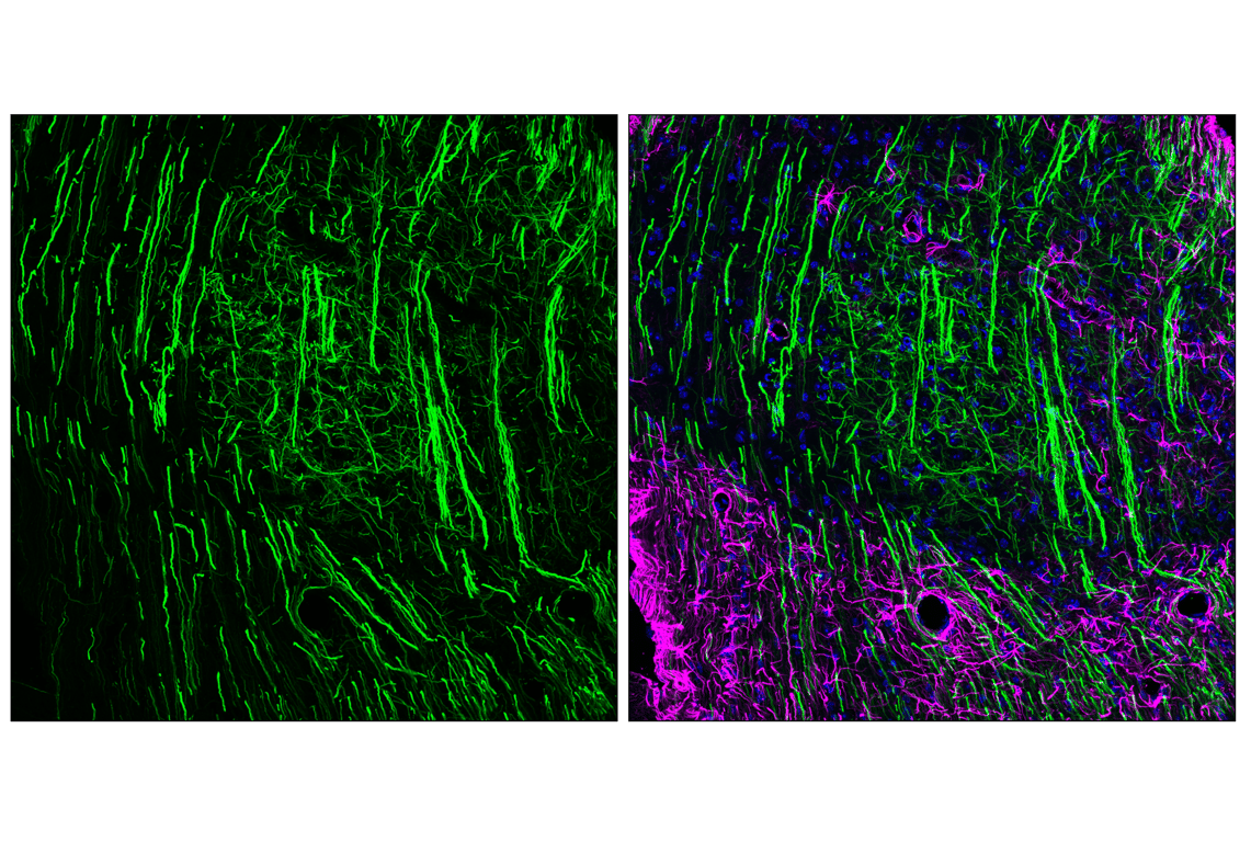 Immunofluorescence Image 1: Peripherin (F3J1R) Rabbit Monoclonal Antibody