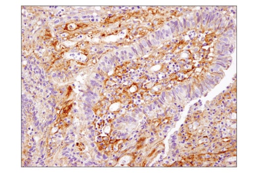 Immunohistochemistry Image 2: B7-H3 (D9M2L) Rabbit Monoclonal Antibody