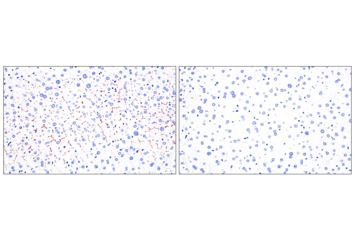 Immunohistochemistry Image 9: CD10/Neprilysin (F4P6H) Rabbit Monoclonal Antibody (BSA and Azide Free)