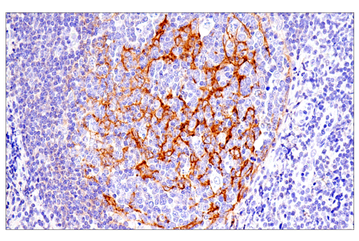 Immunohistochemistry Image 1: CD21/CR2 (2G9) Mouse Monoclonal Antibody