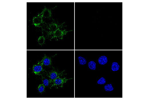 Immunofluorescence Image 1: TIM-3 (E9K5D) Rabbit Monoclonal Antibody