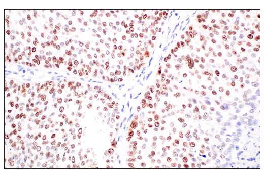 Immunohistochemistry Image 2: p53 (DO-1) Mouse Monoclonal Antibody