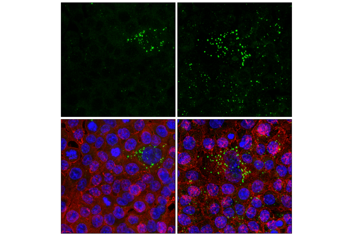 Immunofluorescence Image 3: WIPI2 (2A2) Mouse Monoclonal Antibody