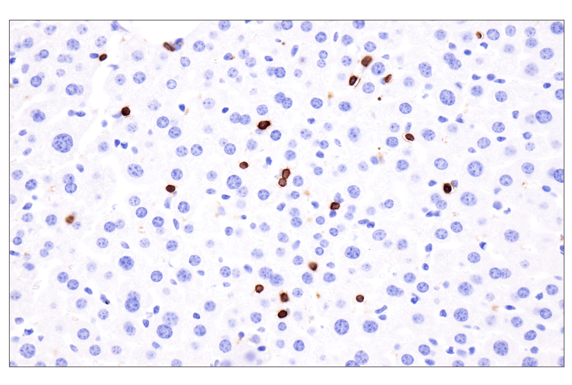Immunohistochemistry Image 6: CD79A (F3Z1H) Rabbit Monoclonal Antibody