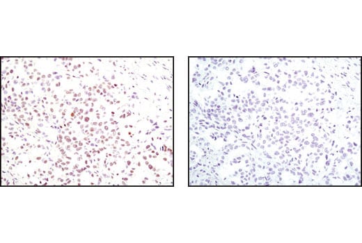 Immunohistochemistry Image 4: Phospho-ATF-2 (Thr69/71) Antibody
