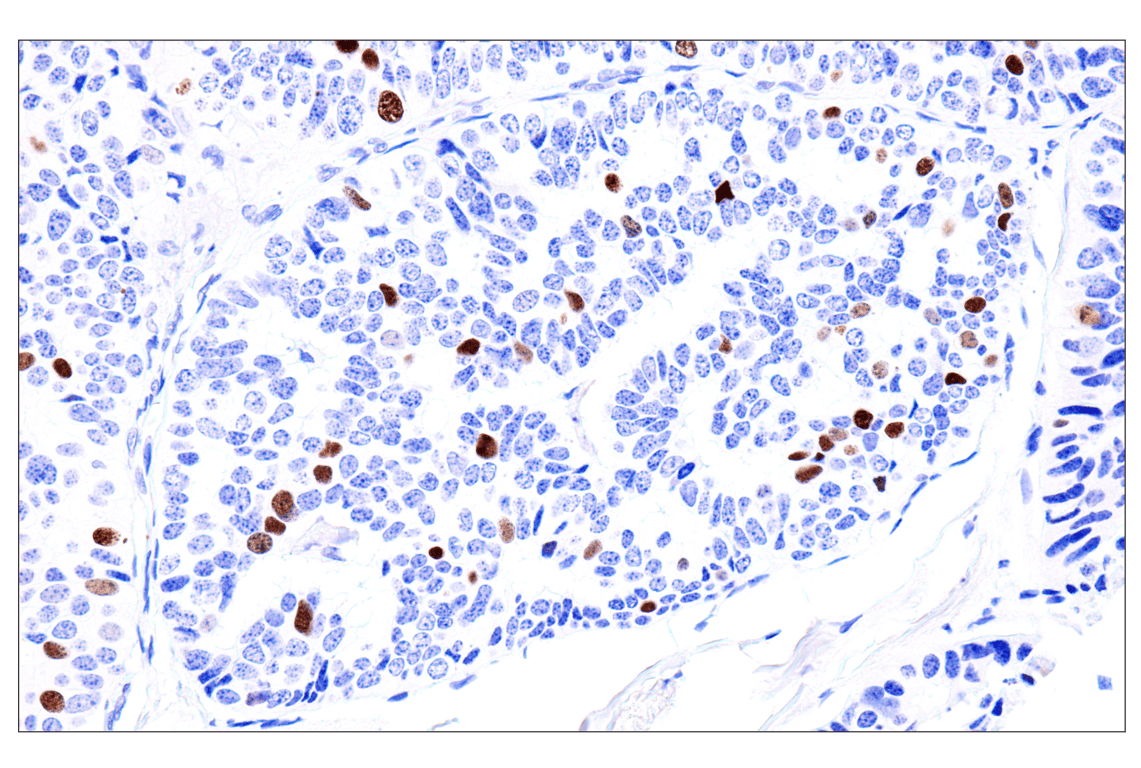 Immunohistochemistry Image 1: Phospho-NPM1 (Thr199) (E4C7S) Rabbit Monoclonal Antibody (BSA and Azide Free)