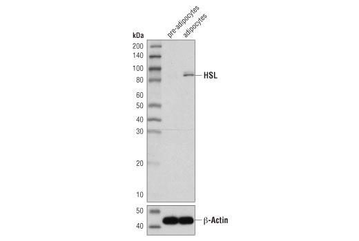 Western Blotting Image 2: HSL (D6W5S) Rabbit Monoclonal Antibody