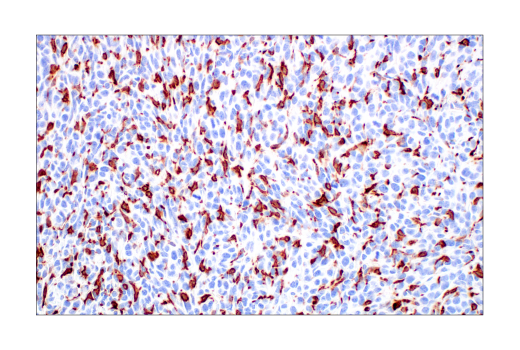 Immunohistochemistry Image 2: CD206/MRC1 (E6T5J) Rabbit Monoclonal Antibody