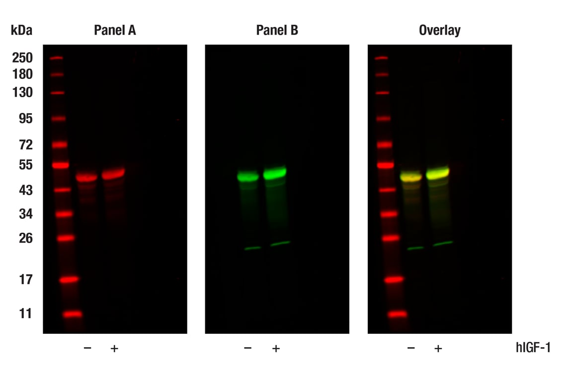 Western Blotting Image 1: Phospho-GSK-3 beta (Ser9) (D85E12) Rabbit Monoclonal Antibody