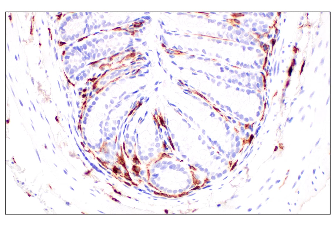 Immunohistochemistry Image 7: CD11b/ITGAM (E4K8C) Rabbit Monoclonal Antibody