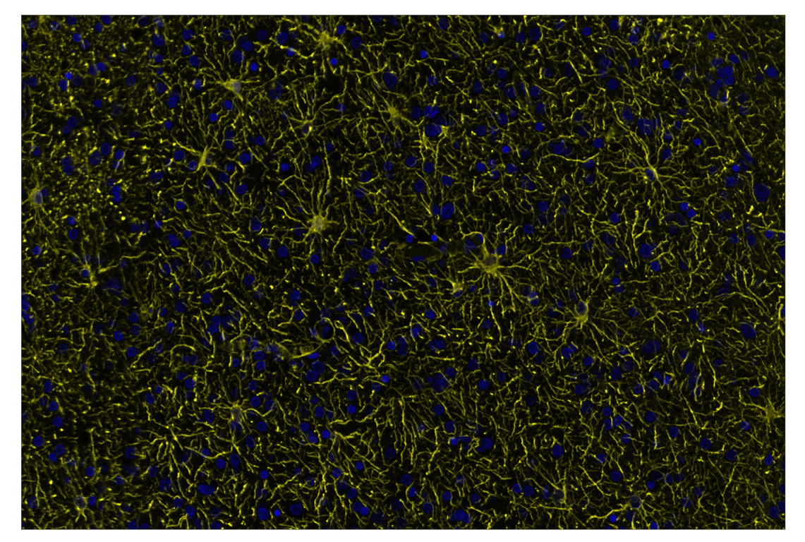 Immunohistochemistry Image 2: GFAP (E4L7M) & CO-0097-647 SignalStar<sup>™</sup> Oligo-Antibody Pair