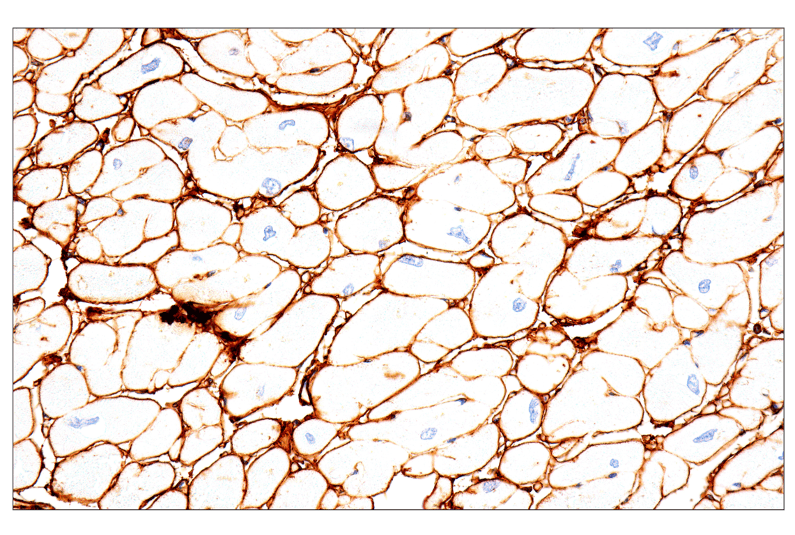 Immunohistochemistry Image 8: COL1A1 (E8F4L) Rabbit Monoclonal Antibody