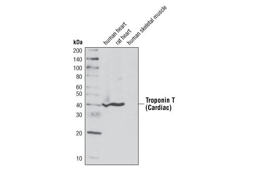 Western Blotting Image 2: Troponin T (Cardiac) Antibody