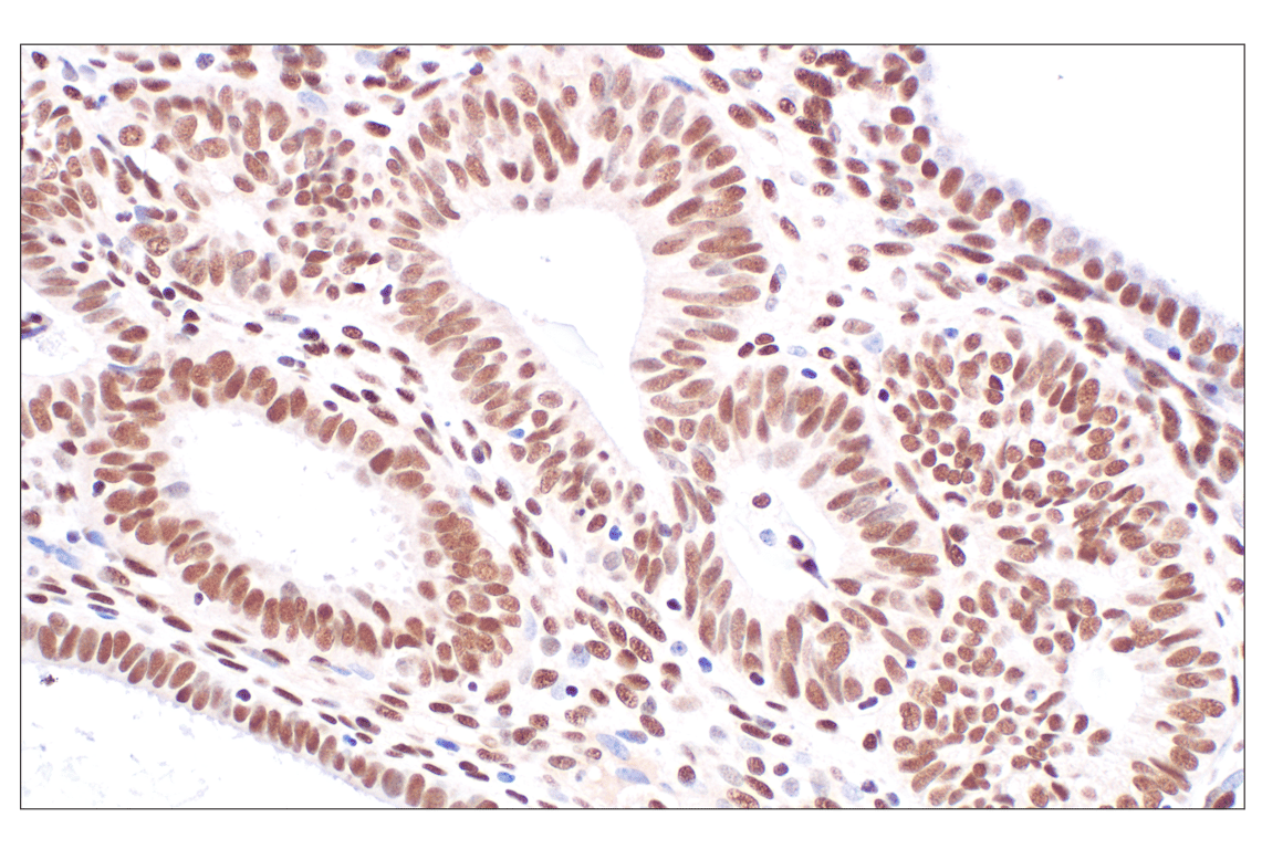 undefined Image 10: PPAR gamma Regulated Fatty Acid Metabolism Antibody Sampler Kit
